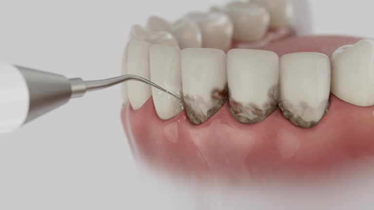 Reliable Dental contractor in Liberty, MO by Smile Center Dentistry